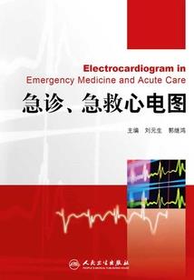 仙境传说手游无视防御