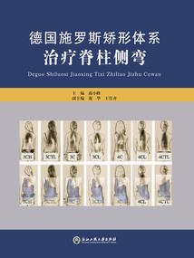 貂蝉买什么装备
